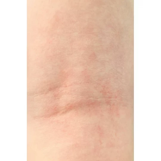 Dexeryl Crème - image 3