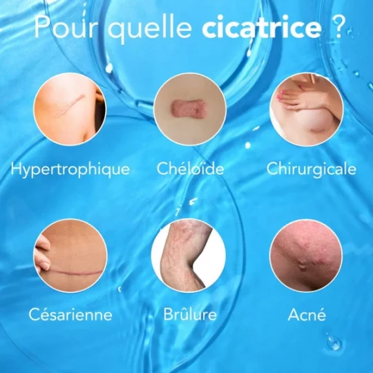 Kelo-Cote Gel UV pour Cicatrices SPF30 - image 24