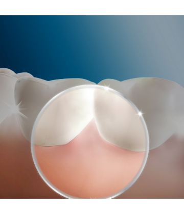 Oral'B Waterjet Canules x 4