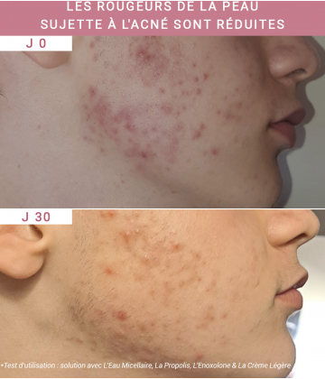 Etat Pur Actif Pur Enoxolone 15 ml
