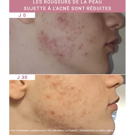 Etat Pur Actif Pur Enoxolone 15 ml - image 2