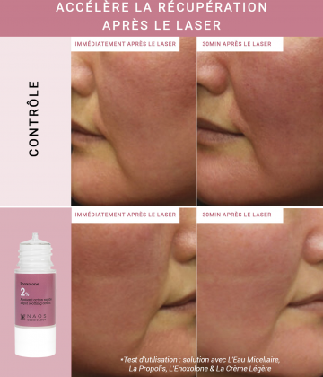 Etat Pur Actif Pur Enoxolone 15 ml