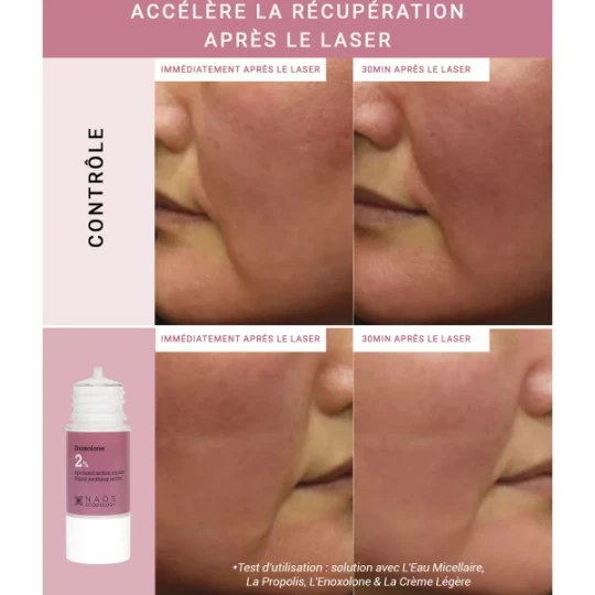 Etat Pur Actif Pur Enoxolone 15 ml - image 3