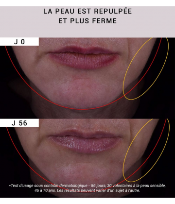 Etat Pur Actif Pur Resvératrol Vieillissement Cutané 15 ml