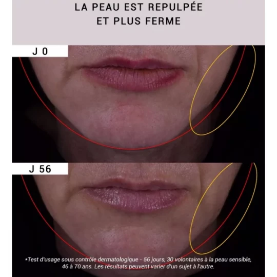 Etat Pur Actif Pur Resvératrol Vieillissement Cutané 15 ml - image 4