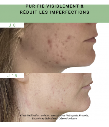 Etat Pur Actif Pur Propolis 15 ml