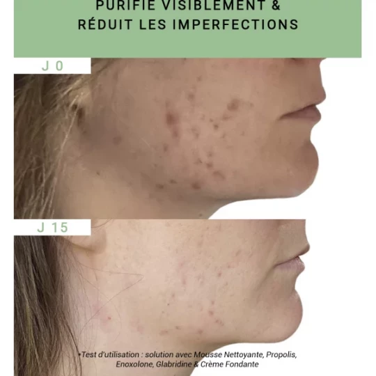 Etat Pur Actif Pur Propolis 15 ml - image 7