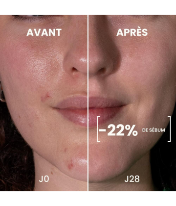 Pulpe de Vie Sérum Visage Anti-Imperfections NoFilter Bio 30 ml - image 3