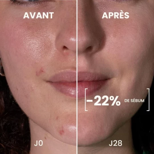 Pulpe de Vie Sérum Visage Anti-Imperfections NoFilter Bio 30 ml - image 4