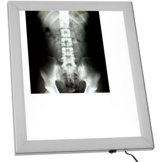 Négatoscope AF300 LED Extra-plat 1 Plage Format A3