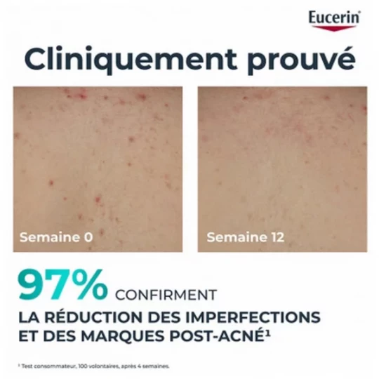 Eucerin DermoPure Crème Corps Triple Action 200 ml - image 5