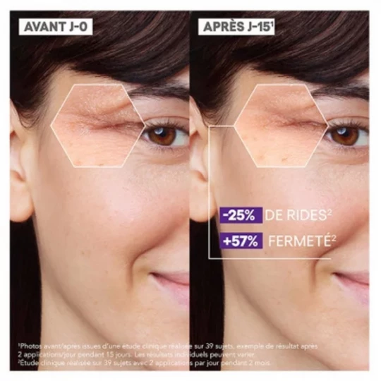 A-Derma Epitheliale Ultra Repair Sérum Multi-Réparateur 30 ml - image 4