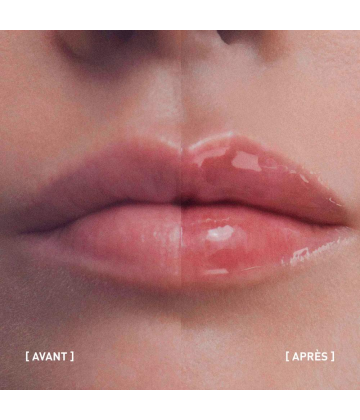 Filorga Hyalu-Filler Lips Soin Lèvres Volumateur 4 g