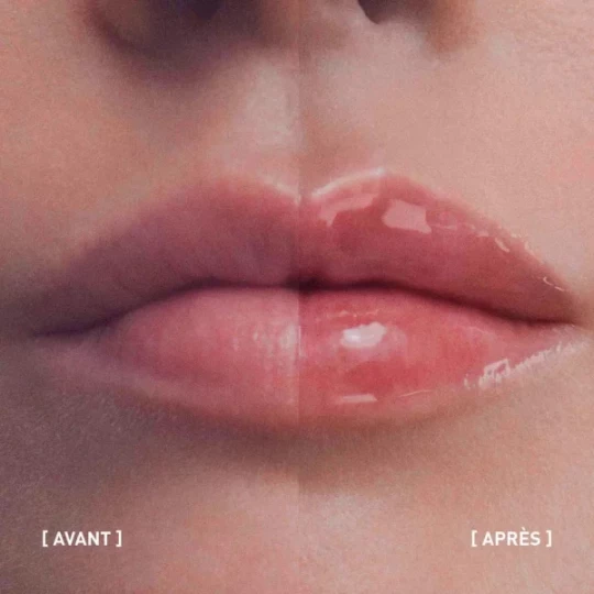 Filorga Hyalu-Filler Lips Soin Lèvres Volumateur 4 g - image 4