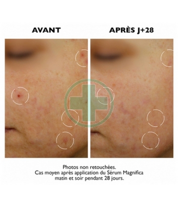 Sanoflore Magnifica Sérum Global Anti-Imperfections 30 ml