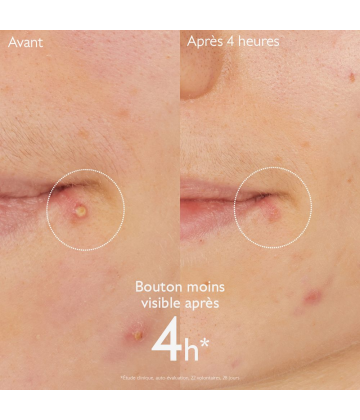 Caudalie Vinopure Stop Bouton Tube 15 ml