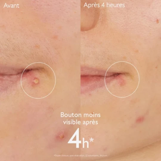 Caudalie Vinopure Stop Bouton Tube 15 ml - image 2