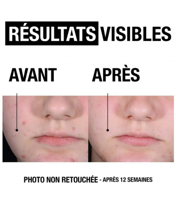 Neutrogena Anti-Bouton+ Gel Nettoyant 200 ml - image 3