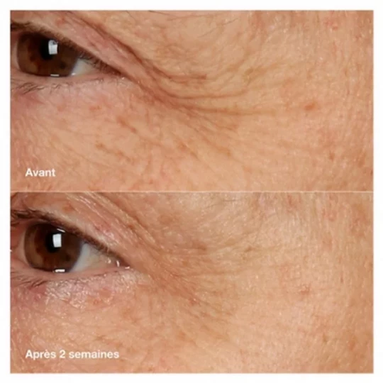 Clinique Smart Clinical Repair Crème + Masque Régénérant Nuit 50 ml - image 3