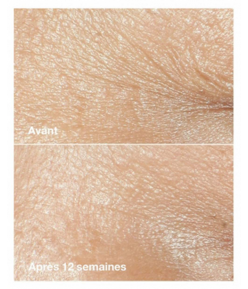 Clinique Smart Clinical Repair Crème Correctrice Anti-Rides 50 ml