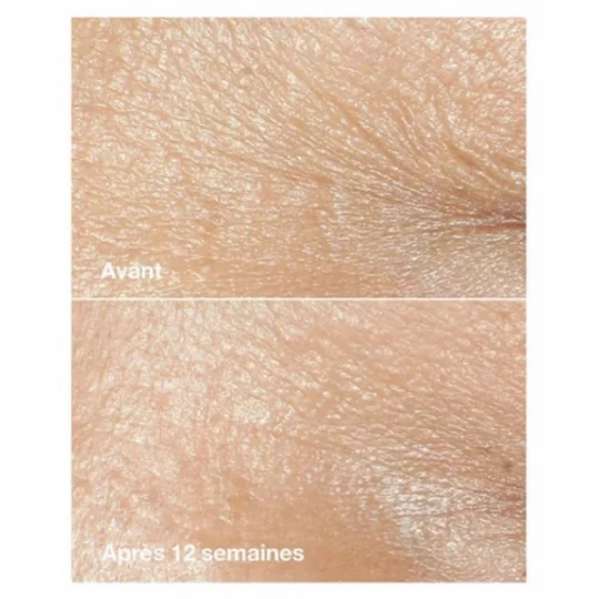 Clinique Smart Clinical Repair Crème Correctrice Anti-Rides 50 ml - image 3