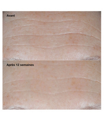 Clinique Smart Clinical Repair Crème Correctrice Anti-Rides SPF30 50 ml