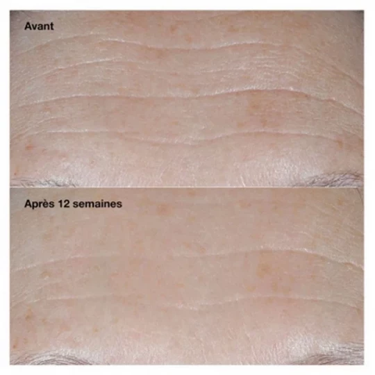 Clinique Smart Clinical Repair Crème Correctrice Anti-Rides SPF30 50 ml - image 3