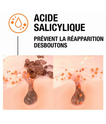 Neutrogena Anti-Boutons Gel Exfoliant 150 ml