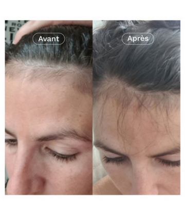 Omum x Chou2 Le Rituel Capillaire