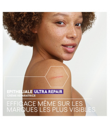 A-Derma Epitheliale A.H Ultra Repair Crème Réparatrice Anti-Marques