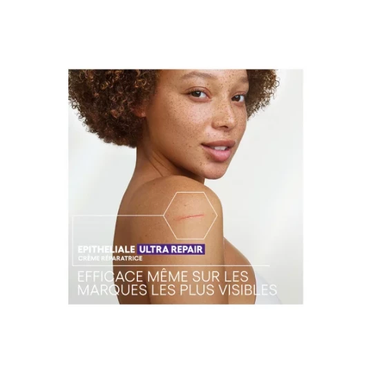 A-Derma Epitheliale A.H Ultra Repair Crème Réparatrice Anti-Marques - image 3
