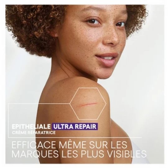 A-Derma Epitheliale A.H Ultra Repair Crème Réparatrice Anti-Marques - image 8