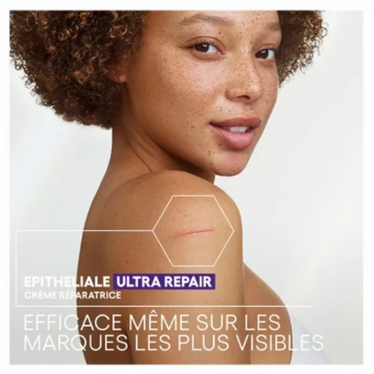 A-Derma Epitheliale A.H Ultra Repair Crème Réparatrice Anti-Marques - image 13