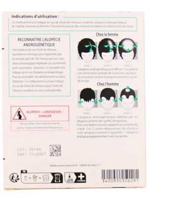 Alopexy 2% 3 x 60 ml