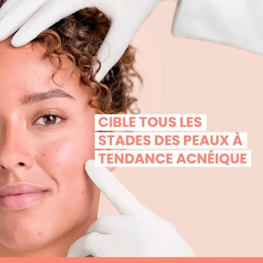 Avène Cleanance Comedomed Sérum Intensif 30 ml - image 4
